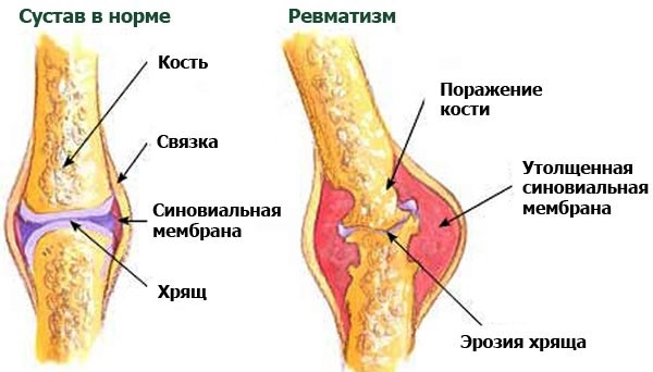 Очанка - лечебные свойства и противопоказания, состав, польза и вред. Особенности применения в народной медицине и косметологии